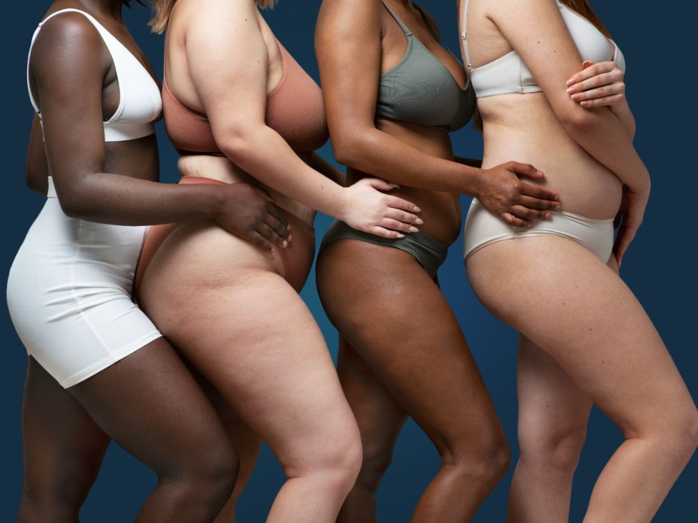 Graus de Celulite: Como Identificar Seus Graus