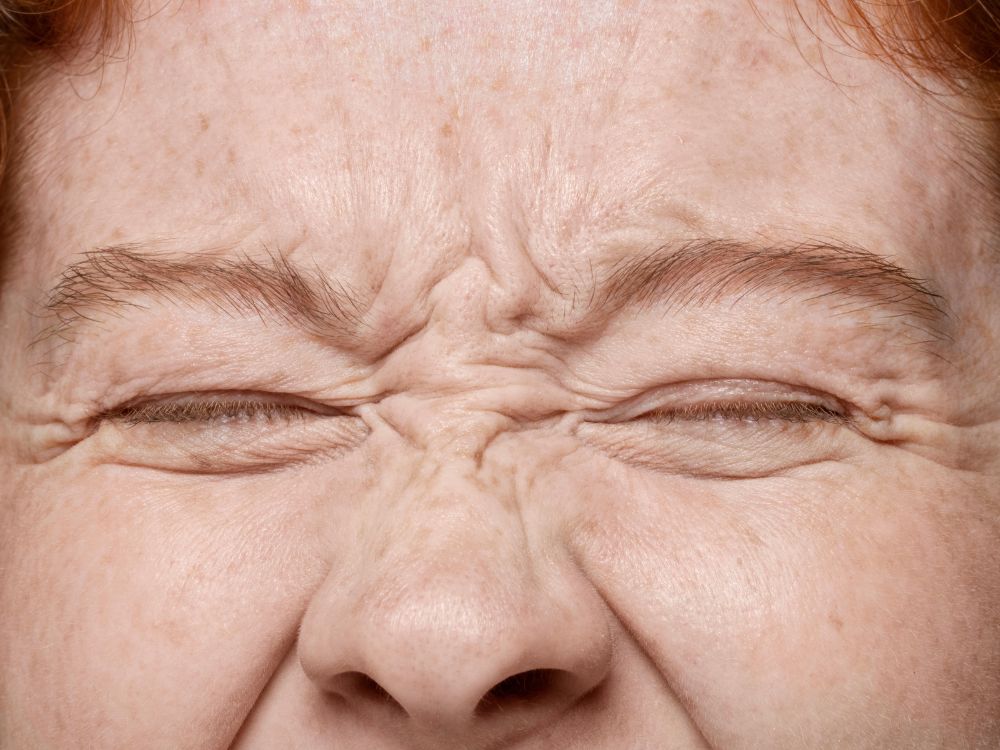 Linhas de Expressão: 5 Dicas Essenciais Para Preveni-lás